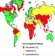 Hepatitis-B