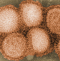 Seasonal-influenza