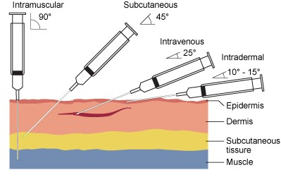 Graphical representation of inserting an ordinary needle into different layers of tissue. 